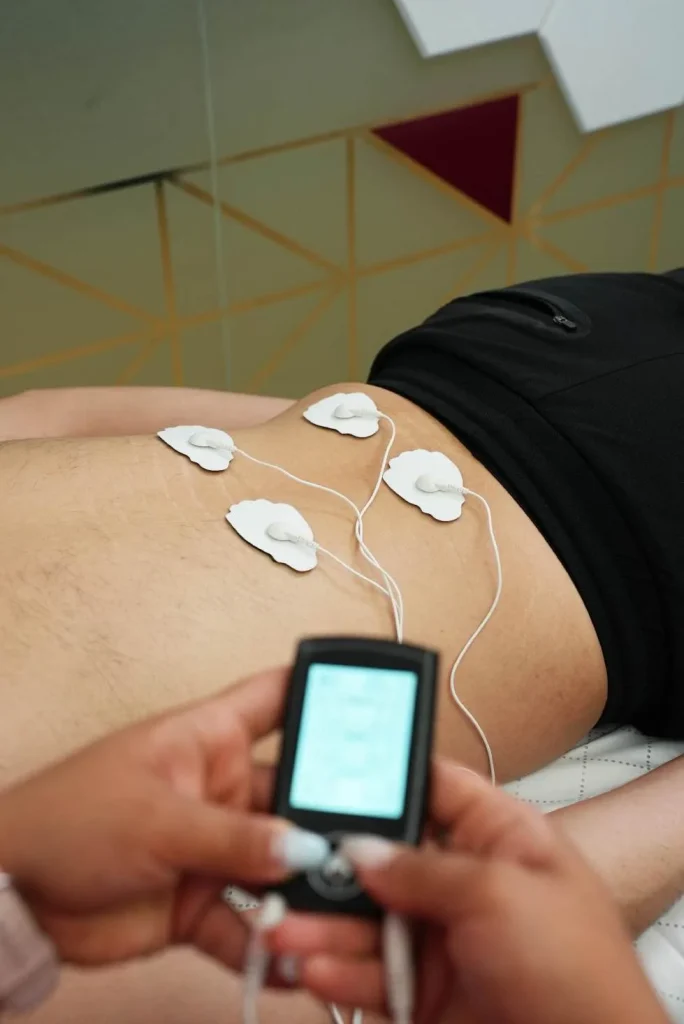 Electroterapia con electrodos en la espalda baja durante una sesión de fisioterapia