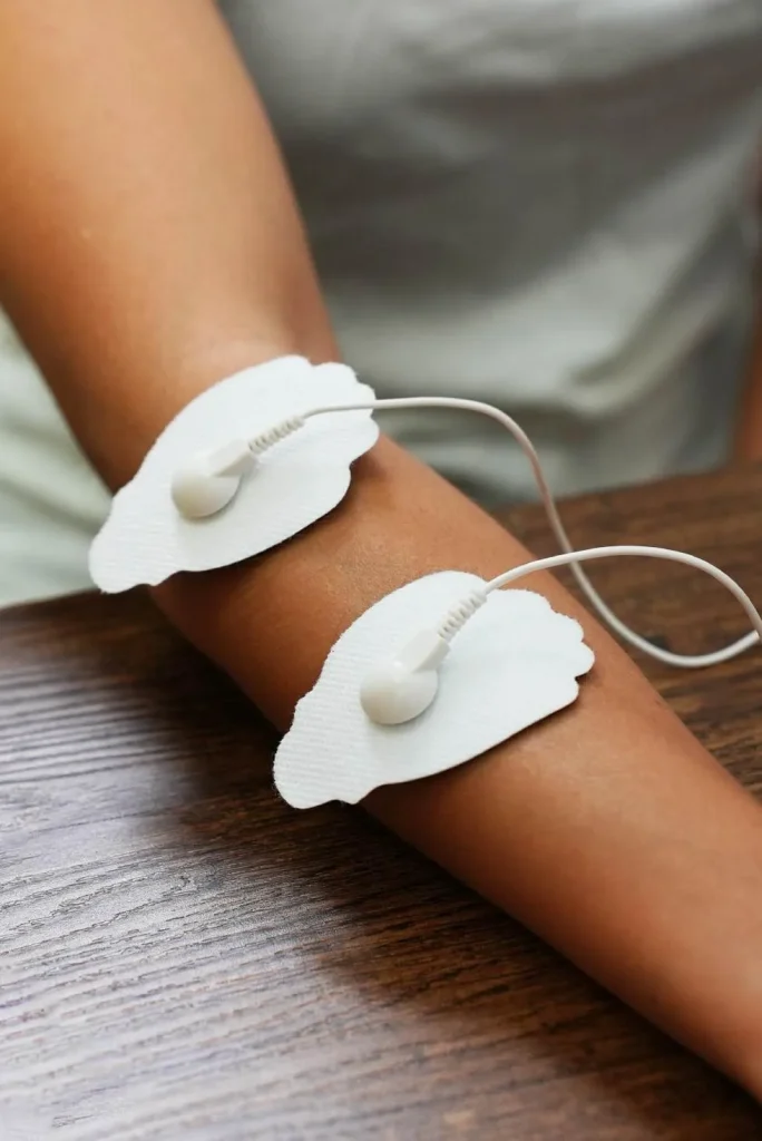 Electrodos en el codo para tratar epicondilitis