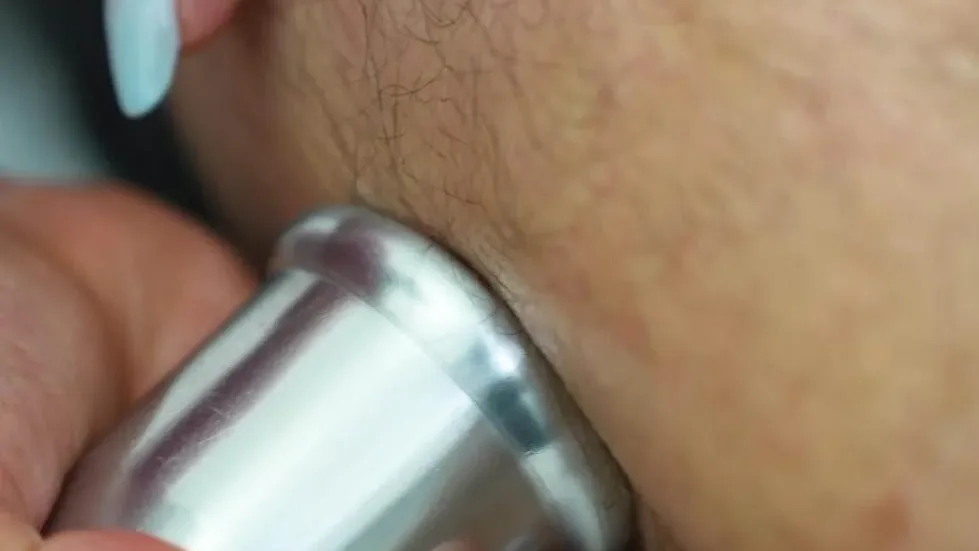 Masaje reductivo con rodillo en el muslo