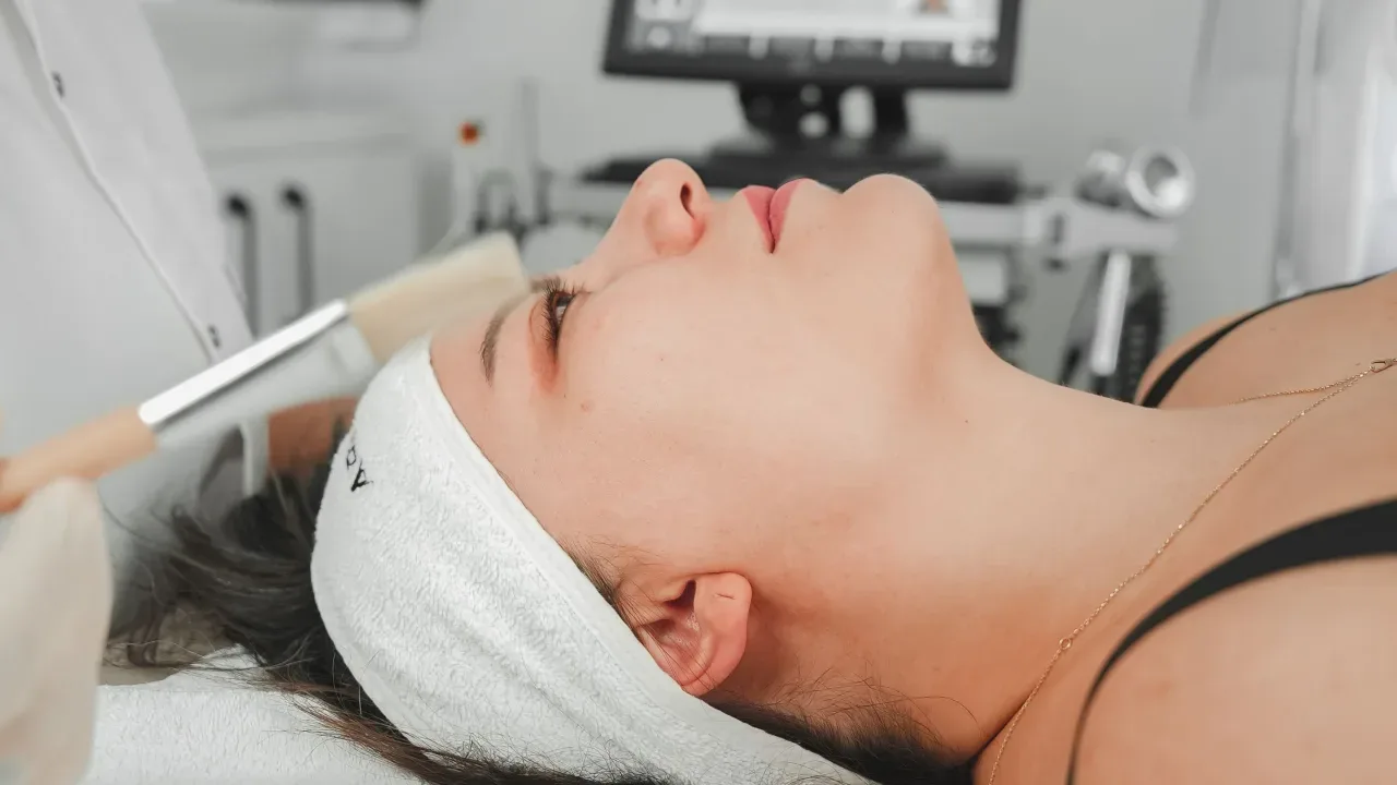 Exfoliación química aplicada por personal capacitado en Puebla