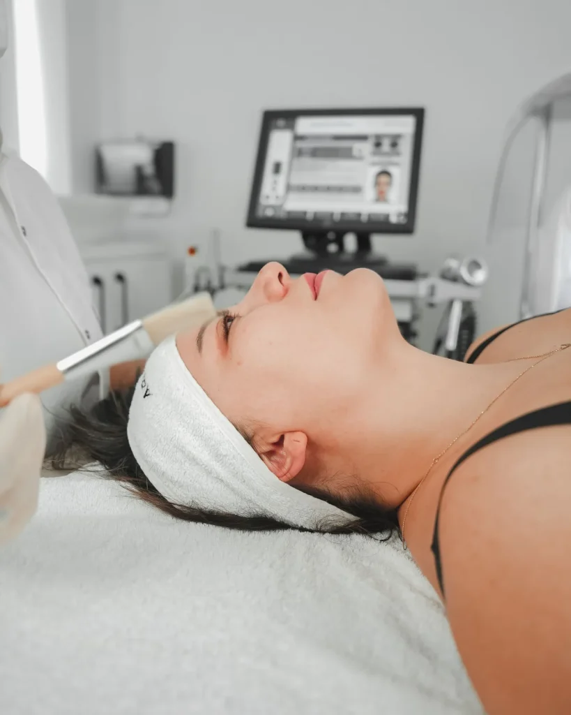 Exfoliación química: tipos y diferencia frente a la mecánica 1 Exfoliación química aplicada por personal capacitado en Puebla