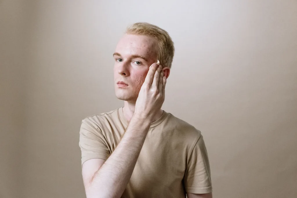 Hombre aplicando un producto exfoliante en el rostro