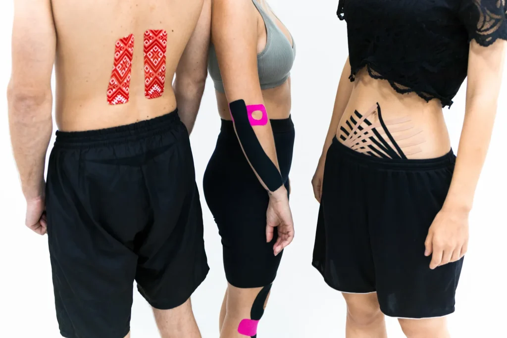 Tiras de kinesiotape aplicadas sobre la piel de un deportista