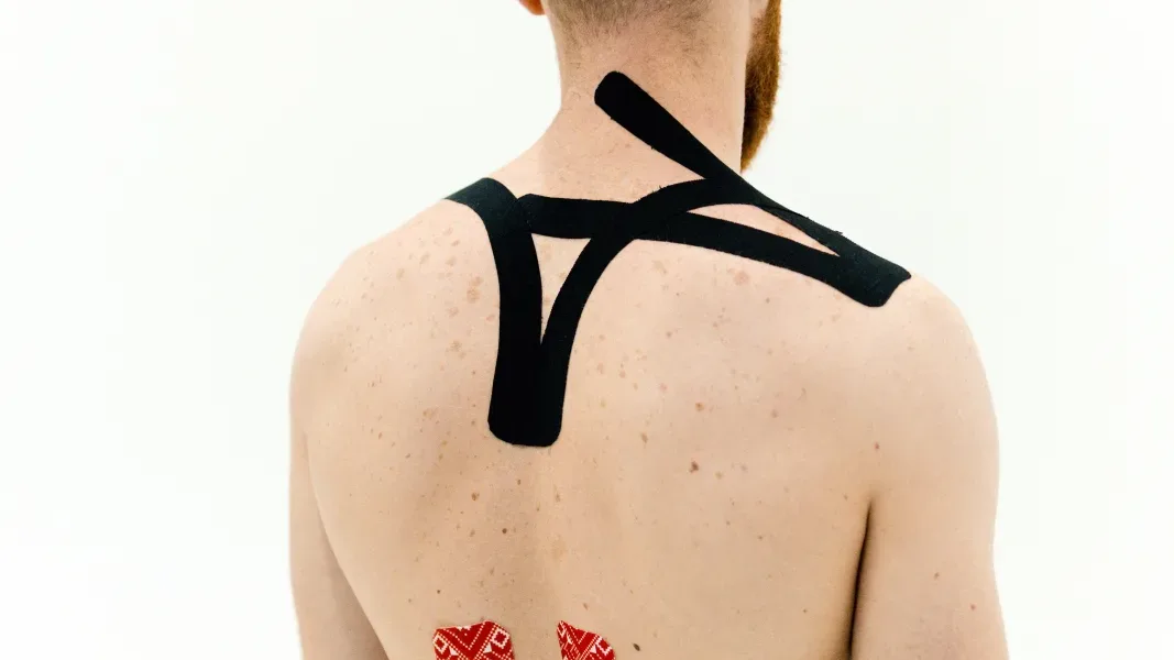 Kinesiotape colocado en la espalda por una fisioterapeuta en Puebla