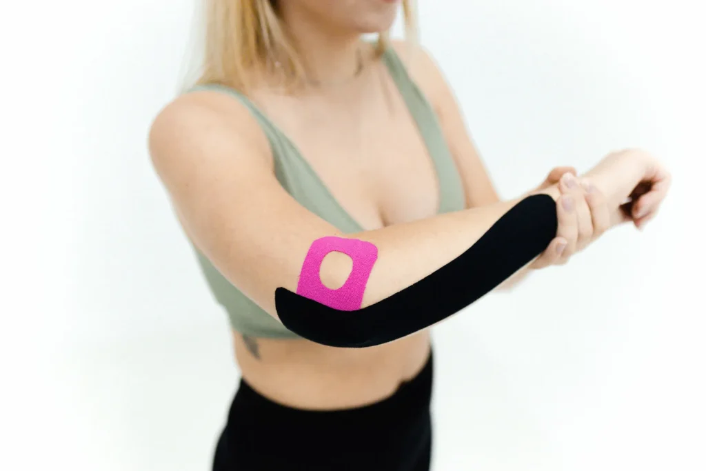 Kinesiotape para epicondilitis: apoyo, no cura del codo 2 Aplicación de kinesiotape en el codo dentro de un plan de fisioterapia