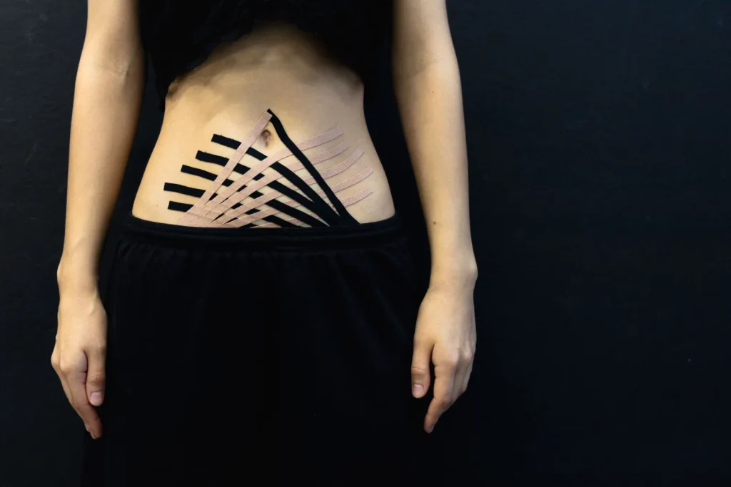 Kinesiotape en el abdomen dentro de un plan de fisioterapia en Puebla