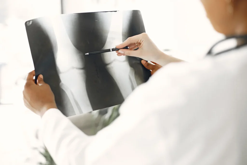 Valoración del dolor de rodilla en una clínica de fisioterapia en Puebla