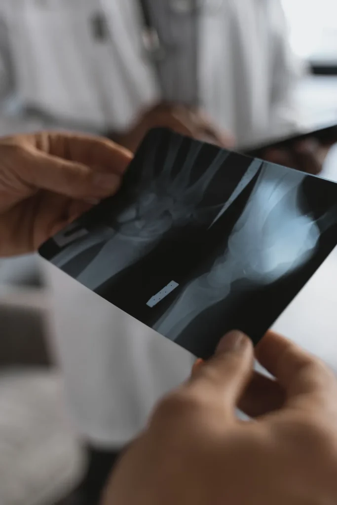 Dolor en el tobillo: aprende qué hacer y qué evitar 2 Exploración del tobillo para localizar la lesión