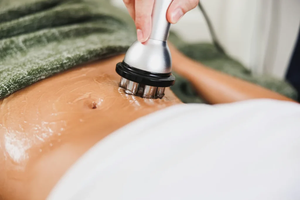 Tratamientos corporales reafirmantes: opciones y expectativas reales 2 Tratamiento corporal con cabezal en el abdomen